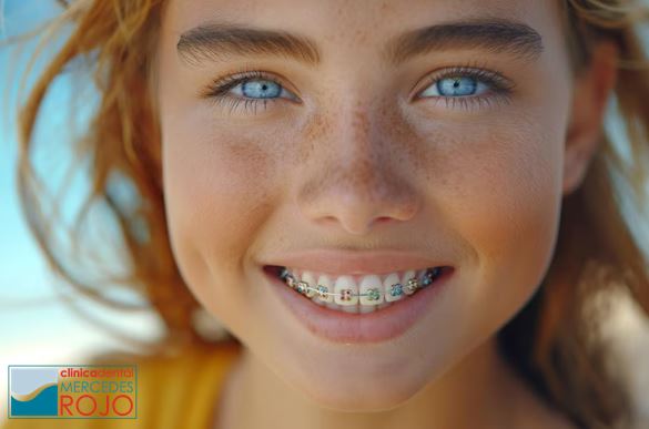 Mujer con brackets